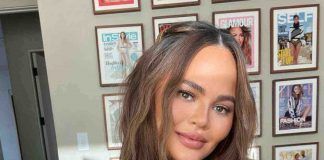 Chrissy Teigen macchie vestito