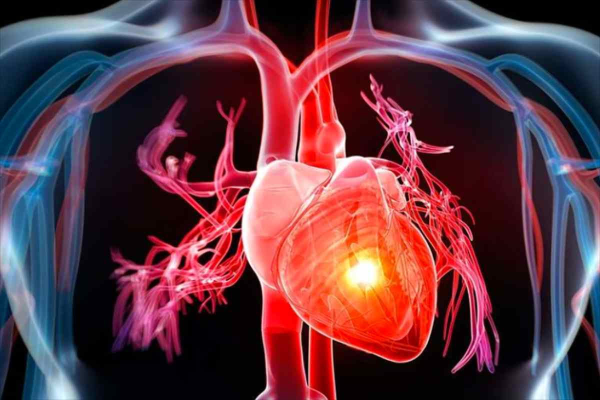 Scompenso cardiaco: ne soffrono 64 milioni di persone