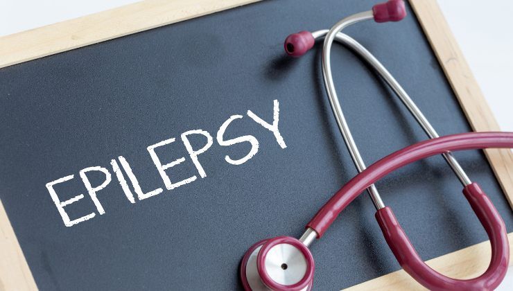 Epilessia